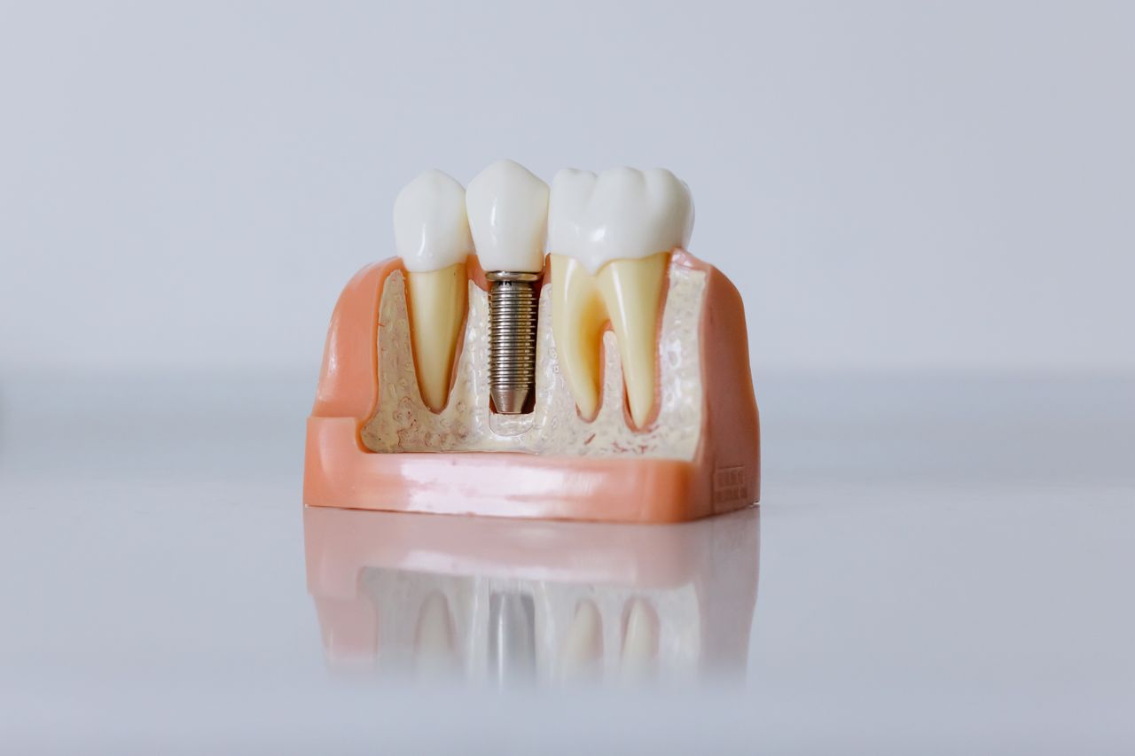 hero-img-01 Detailed dental implant model showcasing teeth structure for educational purposes.