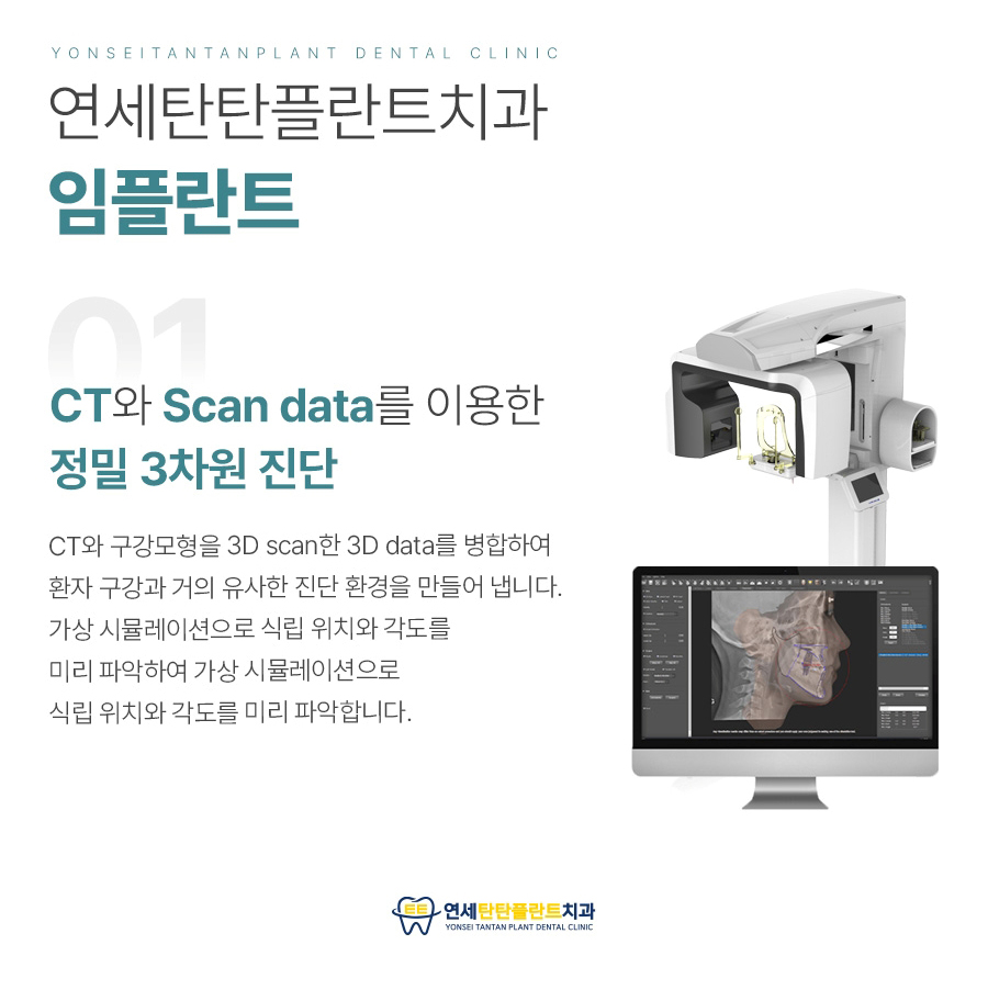 의정부치과 임플란트 이미지 01 (13)