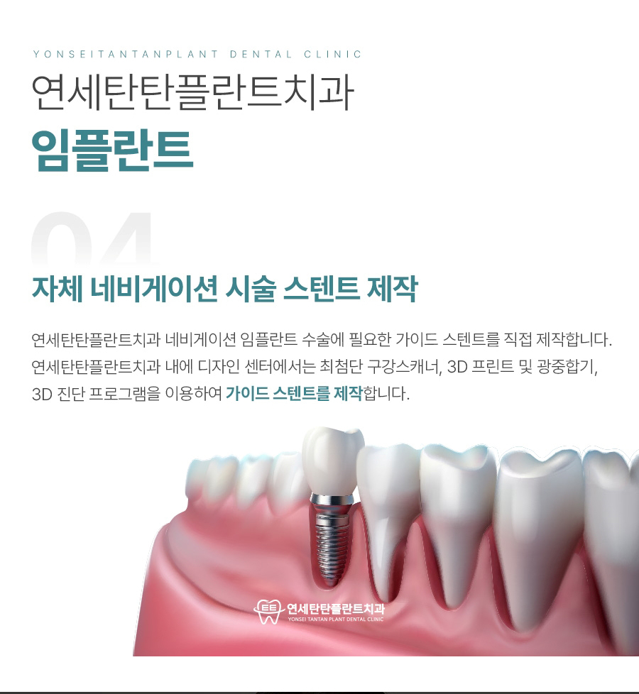 의정부치과 임플란트 이미지 01 (16)