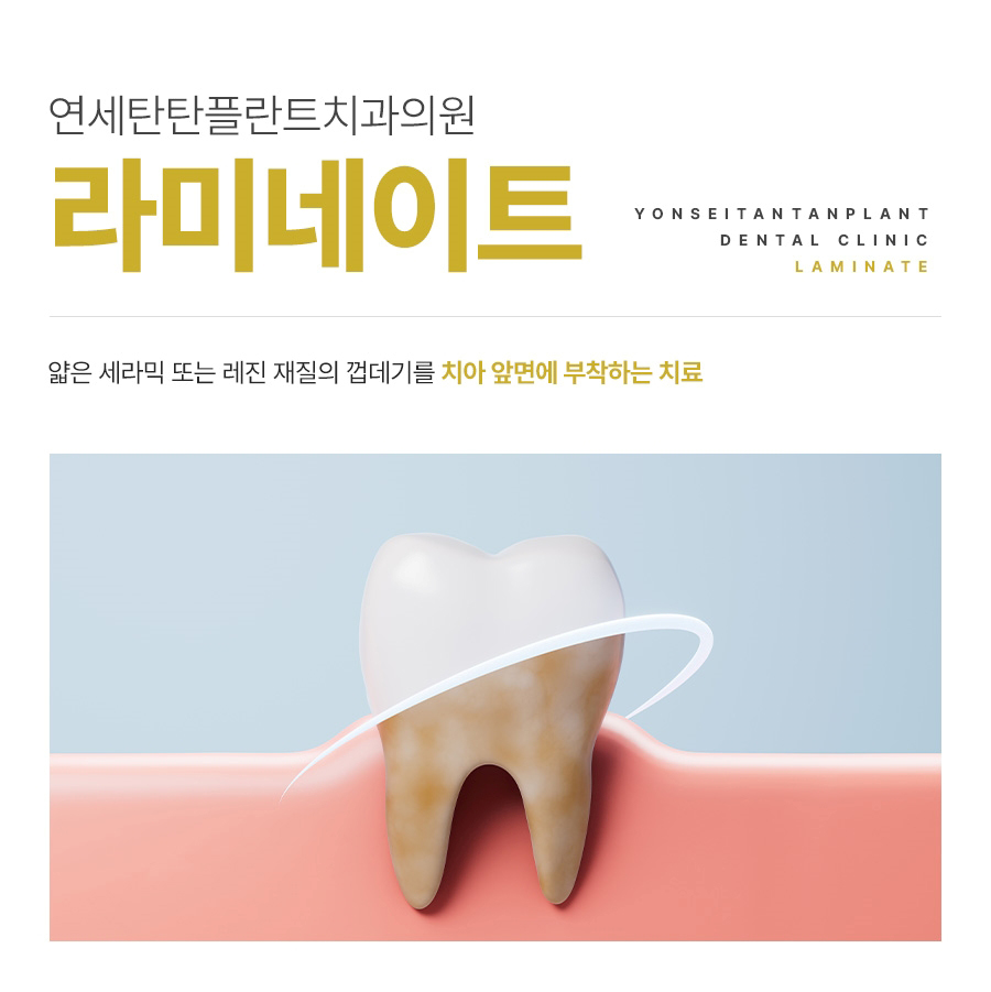 의정부치아미백 라미네이트 메인 이미지 (12)