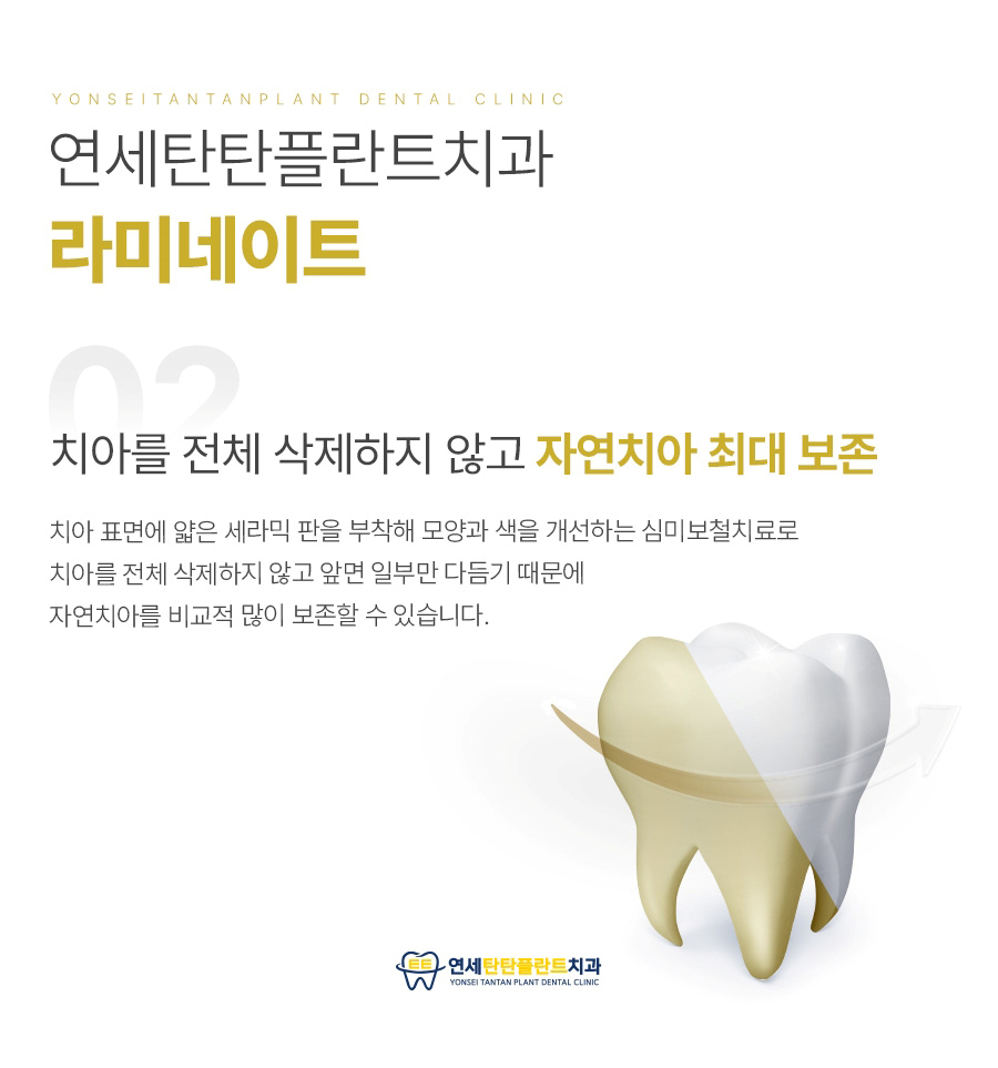 의정부치아미백 라미네이트 메인 이미지 (14)
