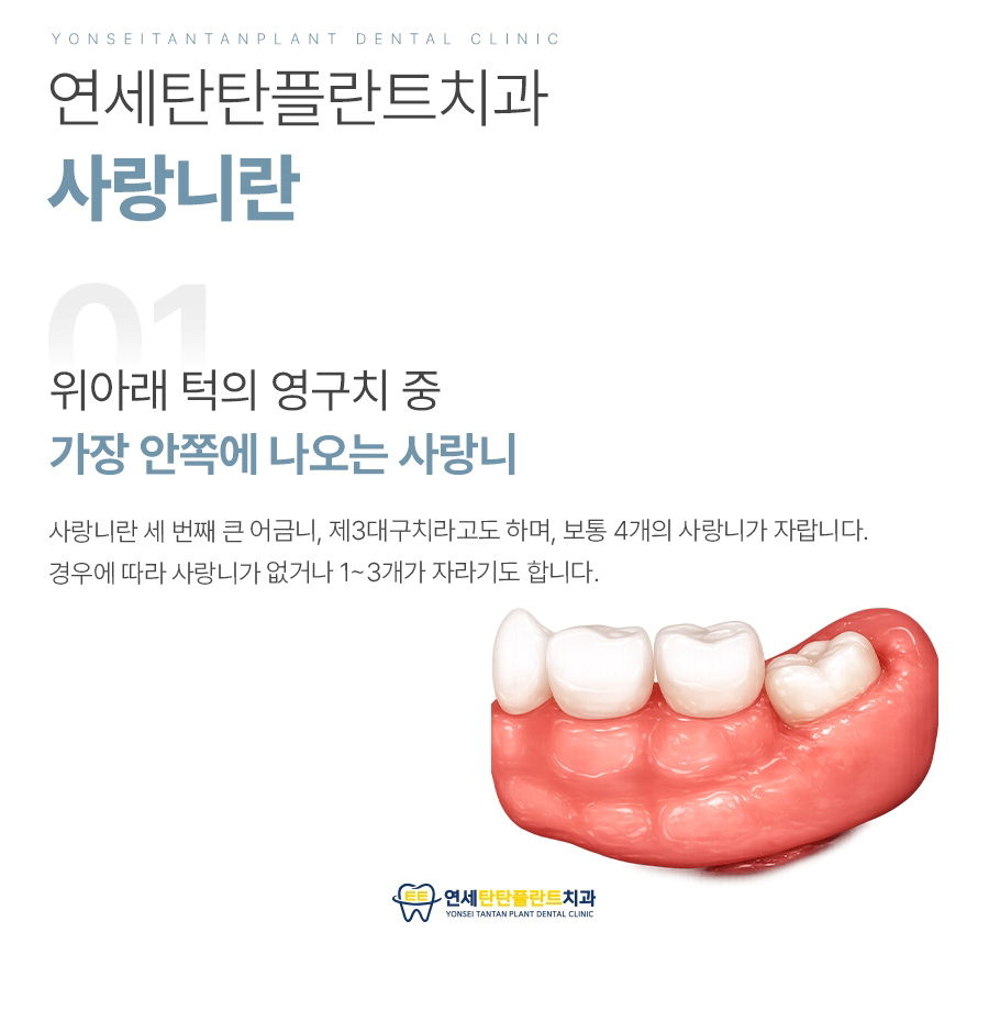 의정부사랑니 사랑니 메인이미지 (13)
